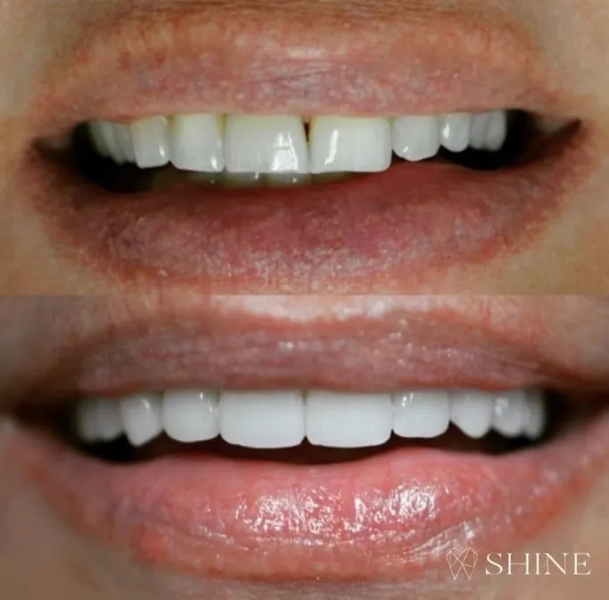 Before and after example